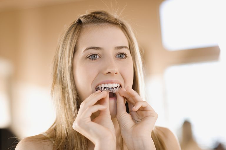 blanchiment dents, votre dentiste, niveau peroxyde, problèmes sensibilité, produits blanchiment