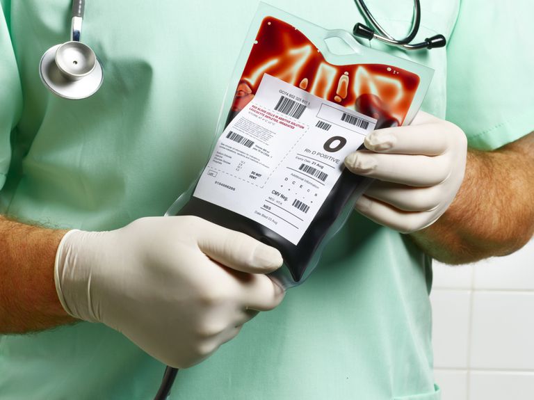 propre sang, besoin transfusion, avant chirurgie, avoir besoin, avoir besoin transfusion, leur propre