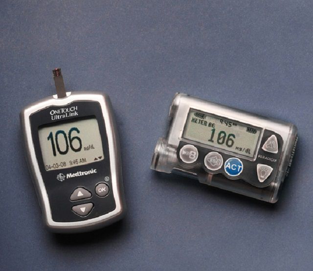 pompe insuline, avec pompe, avec pompe insuline, atteintes diabète, atteintes diabète type, diabète type