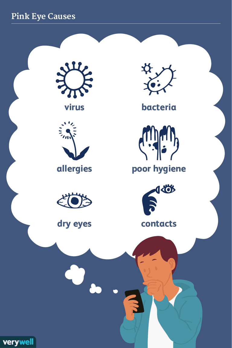 lentilles contact, corps étranger, conjonctivite allergique, conjonctivite virale, herpès simplex, allergies saisonnières