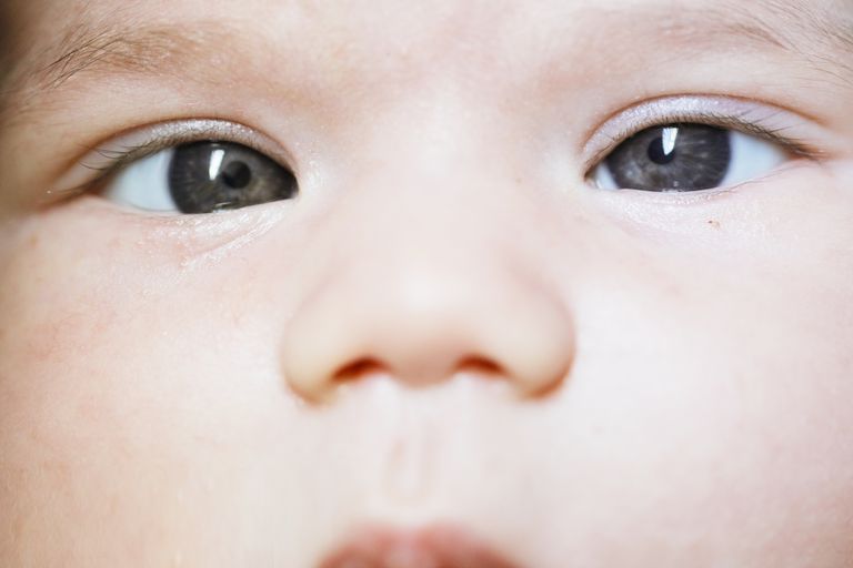 yeux croisés, normal yeux, votre bébé, yeux nouveau-né, bébé problème