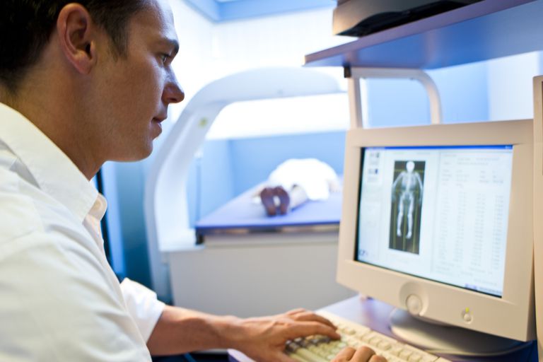 densité osseuse, scan DEXA, facteurs risque, scanner DEXA