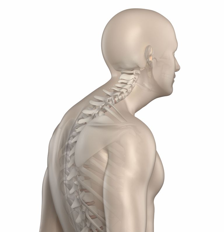 cyphose dorsale, colonne vertébrale, cyphose excessive, peut être, vers avant