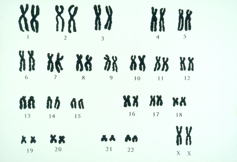 analyse FISH, syndrome Down, analyse FISH caryotype, chaque chromosome, FISH caryotype, peut vous