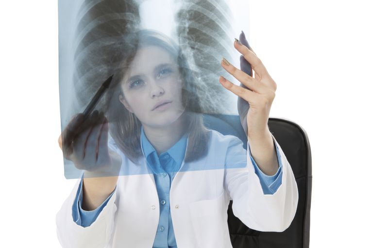 votre médecin, peuvent causer, hamartomes peuvent, hamartomes pulmonaires