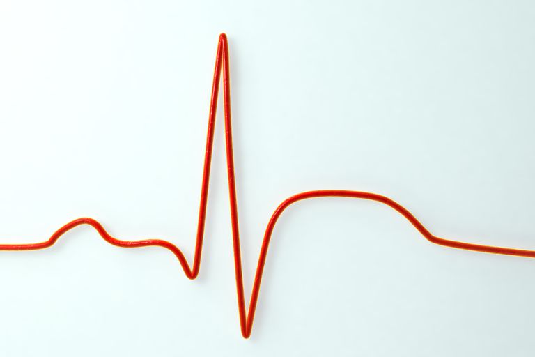 arrêt cardiaque, crise cardiaque, muscle cardiaque, cardiaque arrêt