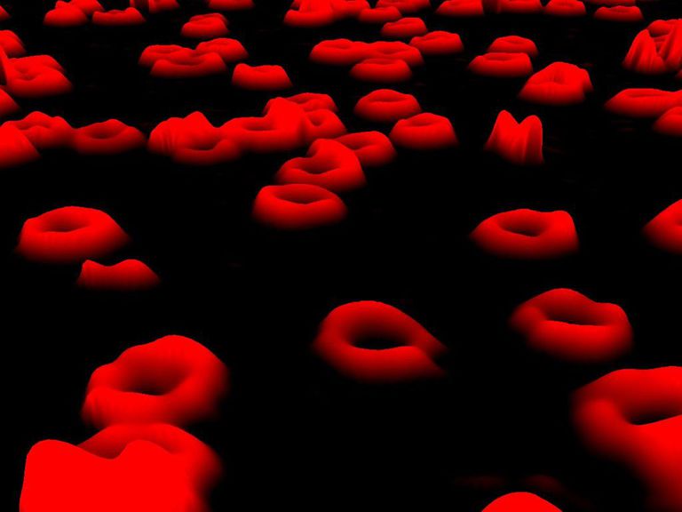 globules rouges, taux hémoglobine, moelle osseuse, autres tests, avec hémoglobine