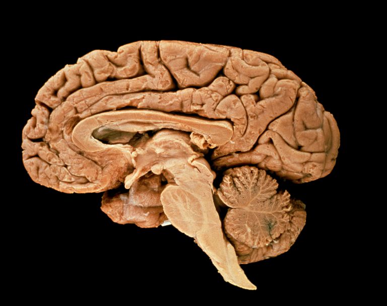 tronc cérébral, comme maladie, tige cérébrale, affecte tige