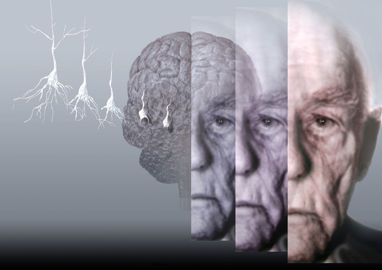 maladie Alzheimer, chaîne comportement, comportements difficiles, chaîne comportement A-B-C, comportement A-B-C, personnes atteintes