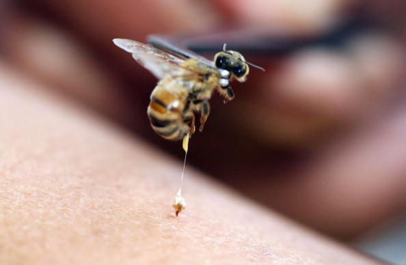 piqûres abeilles, piqûre abeille, réaction anaphylactique, appelez immédiatement, diphenhydramine Benadryl
