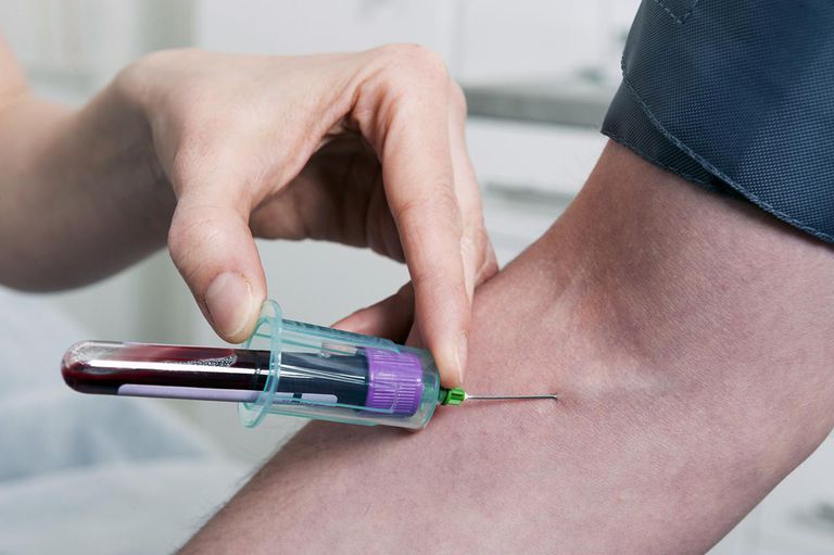 test sanguin, tests sanguins, herpès tests, sanguin herpès, spécifiques type