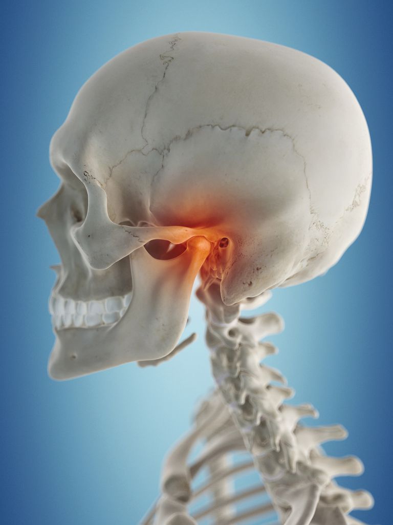 articulation temporo-mandibulaire, déplacement disque, votre mâchoire, avec réduction