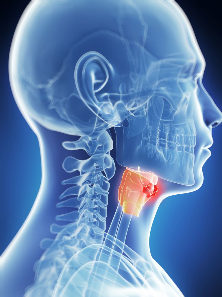 cancer larynx, cordes vocales, vrais cordes vocales, cancer larynx peut, larynx peut, larynx sont