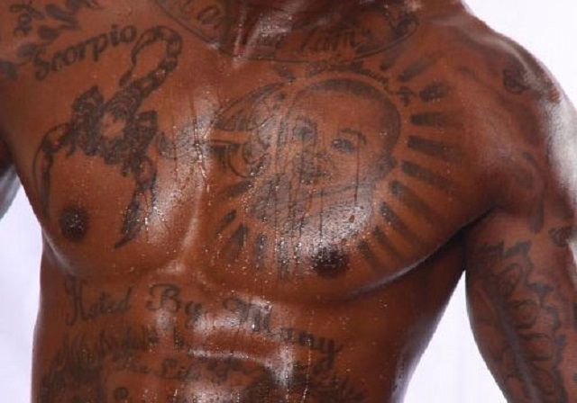 tatouage laser, enlèvement tatouage, enlèvement tatouage laser, autres méthodes