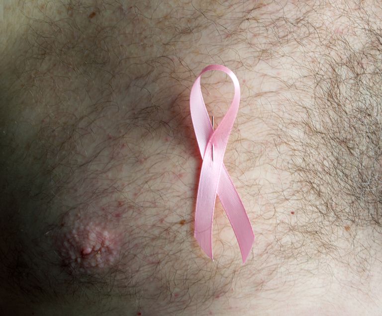 cancer sein, sein chez, cancer sein chez, tissu mammaire, chez hommes