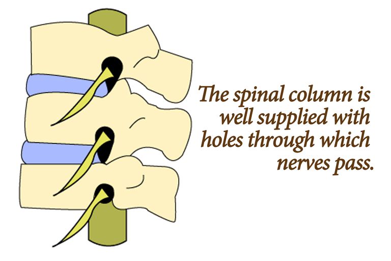 colonne vertébrale, hernie discale, moelle épinière, canal rachidien, peut irriter, produit dans