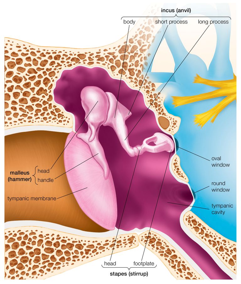 oreille moyenne, dépôts calcium, dans oreille, myringosclerosis tympanosclerosis