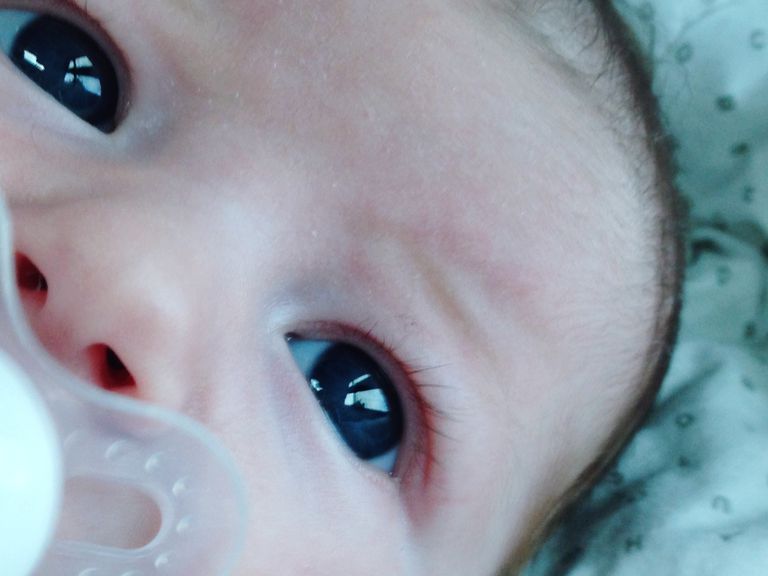 votre bébé, conjonctivite néonatale, peut être, après naissance