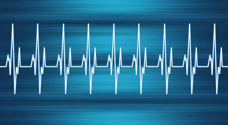 électrique cœur, impulsion électrique, oreillettes ventricules, stimulateur cardiaque, bloc nodal