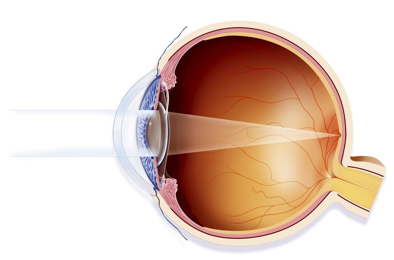 acuité visuelle, peut être, chirurgie cataracte, acuité potentielle, autres maladies, autres maladies oculaires