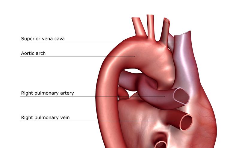 artère pulmonaire, facteurs risque, notre cœur, artérielle pulmonaire, hypertension pulmonaire, artères dans