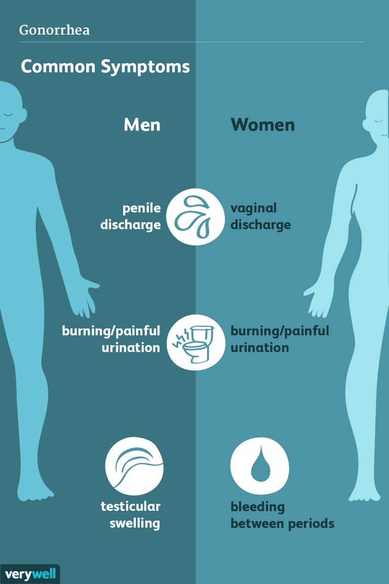 gonorrhée peut, infection peut, chez femme, chez homme, Dans rares, organes génitaux