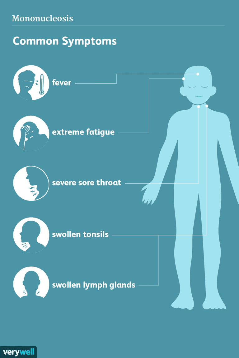 angine streptococcique, symptômes mononucléose, adolescents jeunes, adolescents jeunes adultes, autres maladies, gorge fièvre