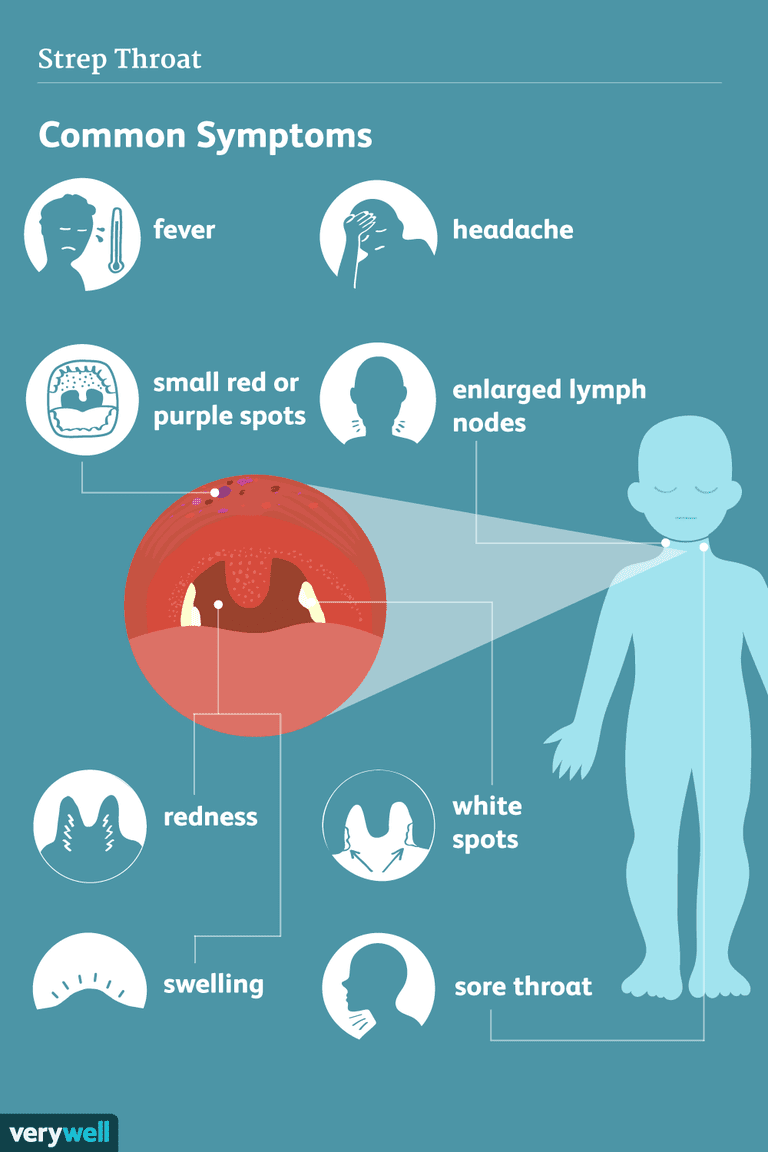 angine streptococcique, angine streptococcique comprennent, après angine, après angine streptococcique, autres symptômes