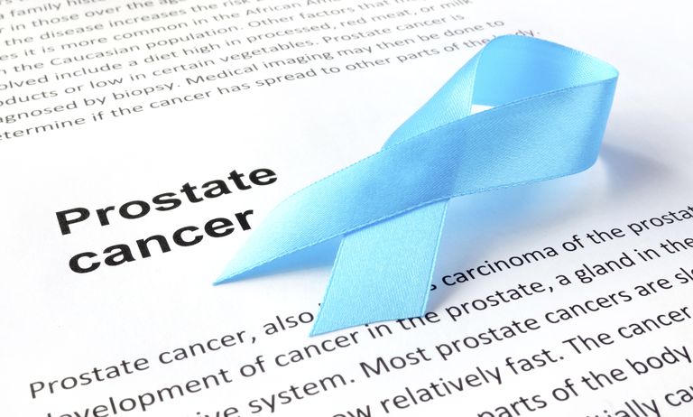 cancer poumon, chez hommes, cancer côlon, cancer prostate, facteurs risque