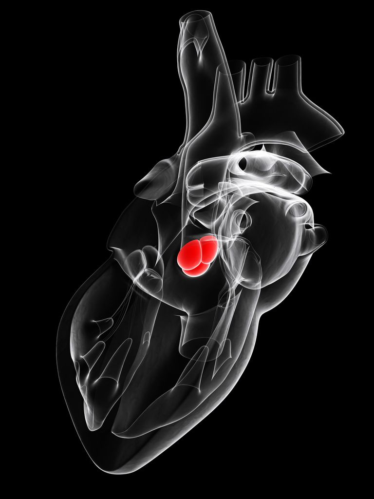 valve aortique, sténose aortique, cœur ouvert, présentant sténose, présentant sténose aortique, chirurgie cœur
