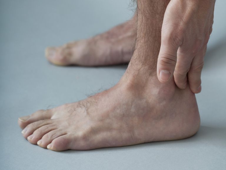 pied cheville, tibiale postérieure, cheville tend, douleur enflure, peut vous, pieds plats
