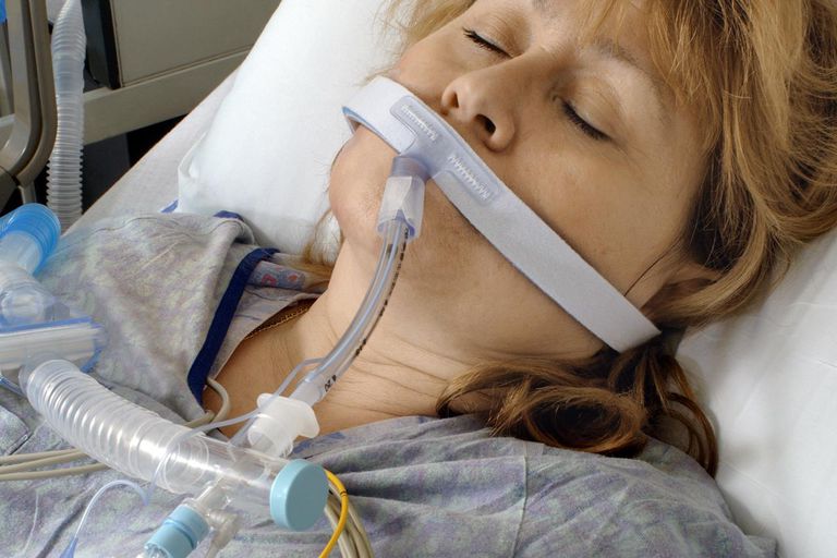 associée ventilateur, avant chirurgie, facteur risque, meilleure santé, peut être, pneumonie acquise