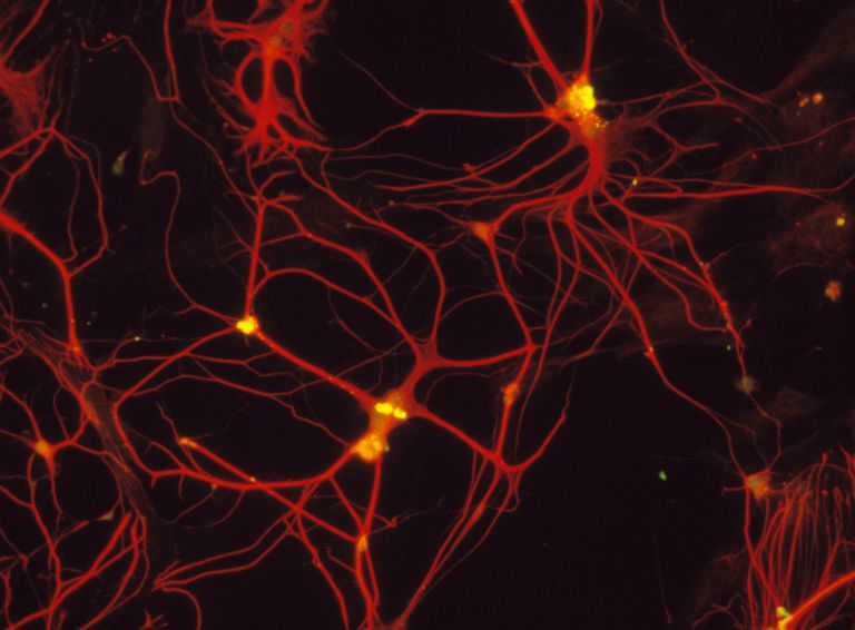 cellules gliales, système nerveux, votre cerveau, cellules satellites, cellules Schwann