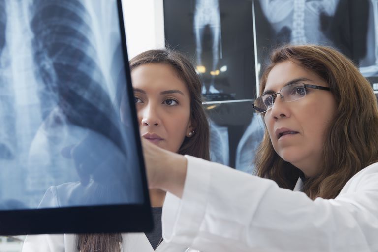 radiographie thoracique, radiographie pulmonaire, oxygène dans, votre médecin, Dans maladie