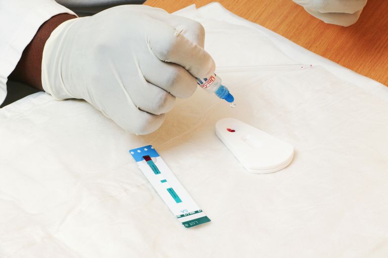 test dépistage, anticorps anti-VIH, résultat négatif, subir test