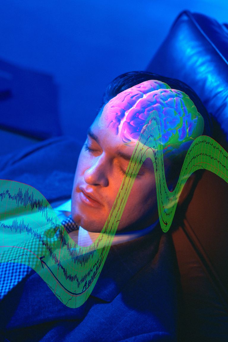 ondes cérébrales, sommeil paradoxal, activité ondes, activité ondes cérébrales, cycle sommeil