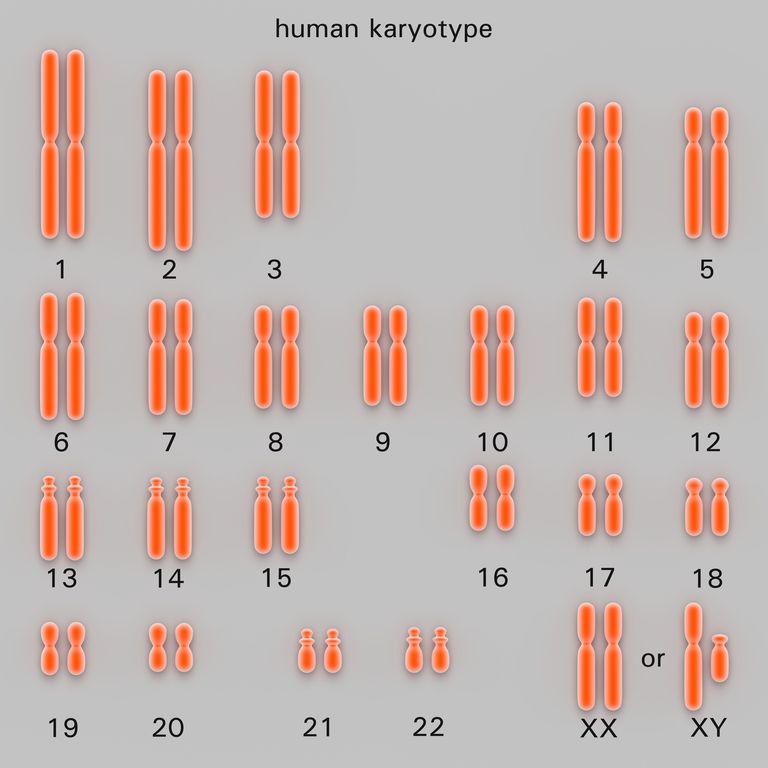 test caryotype, peuvent être, globules blancs, chromosomes sont, peut être, syndrome Down