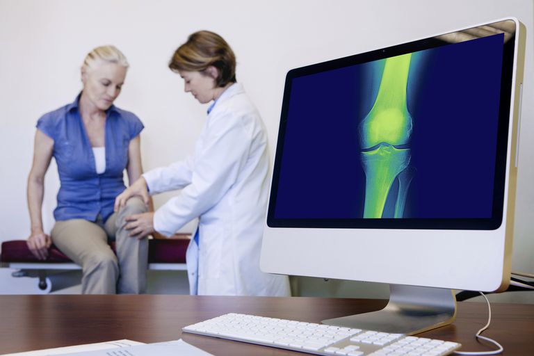 arthrose genou, trois compartiments, compartiments genou, arthrose tricompartimentale, articulation genou, intervention chirurgicale