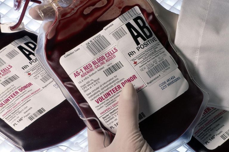 groupe sanguin, transfusion sanguine, groupes sanguins, type sang, importe quel, personne avec
