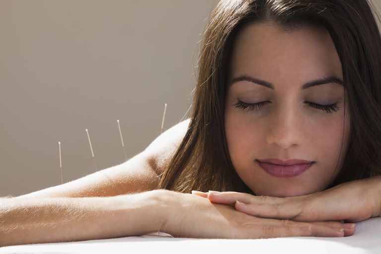 montré acupuncture, acupuncture peut, acupuncture pour, aiguilles stériles, avantages potentiels