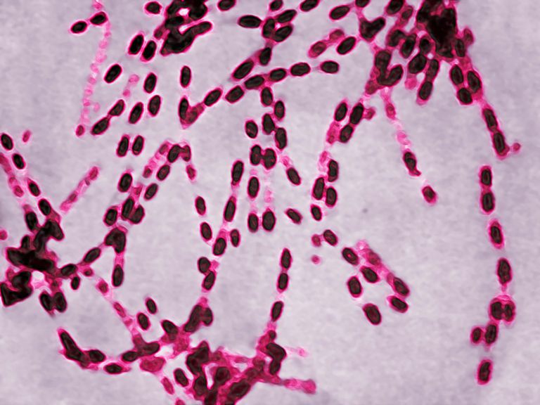anthrax cutané, peut être, dans monde, entraîner infections